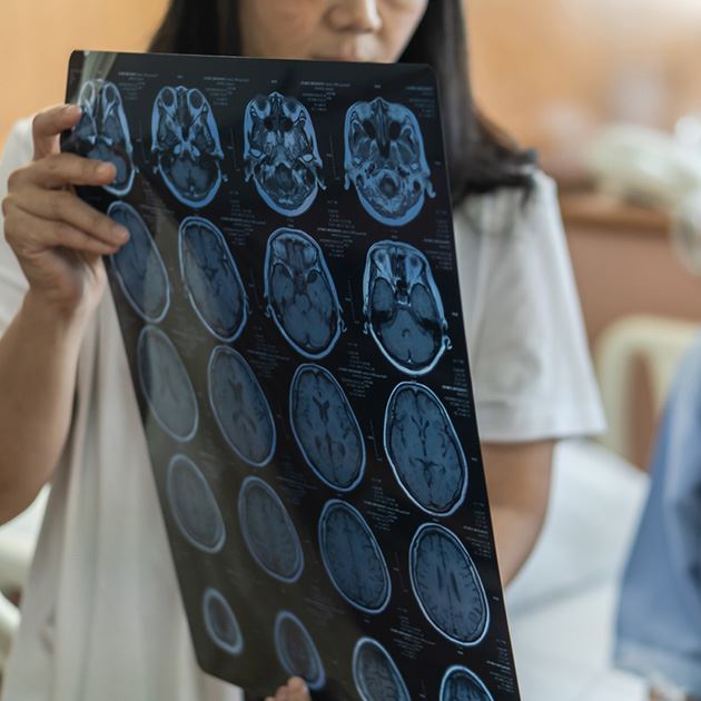 Woman holding a page of brain scans up to show them to another person